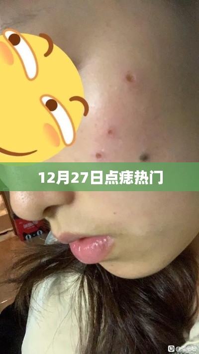 12月27日痣點熱門趨勢揭秘