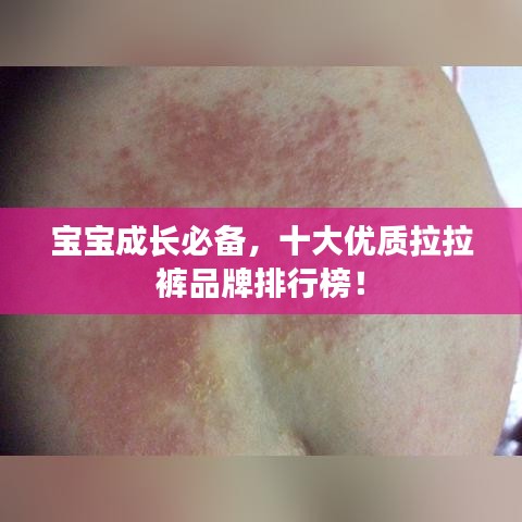 寶寶成長(zhǎng)必備，十大優(yōu)質(zhì)拉拉褲品牌排行榜！