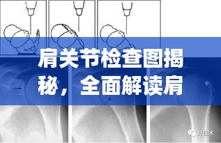 肩關(guān)節(jié)檢查圖揭秘，全面解讀肩關(guān)節(jié)健康與功能狀態(tài)