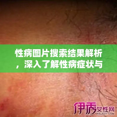 性病圖片搜索結(jié)果解析，深入了解性病癥狀與防治知識
